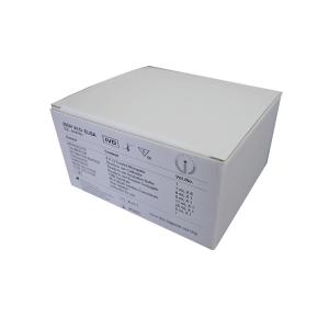 25OH Vitamin D Total Elisa Test Kit 25 Hydroxyvitamin D Total Test