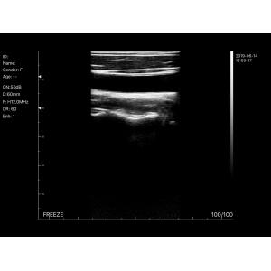 USB WIFI Digital Imaging Linear Array Wireless Ultrasound Probe