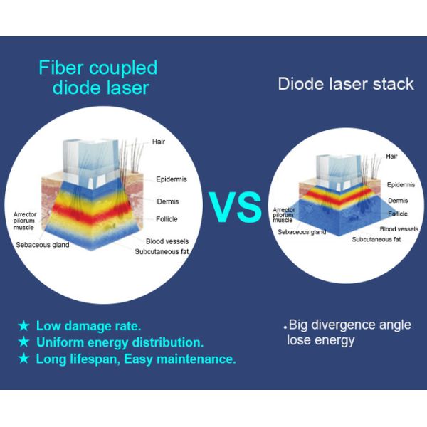 Laser Type Fiber Coupled Hair Removal Laser Machine With TEC Sapphire Contact Cooling
