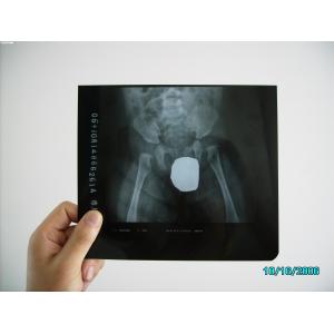 Silver Halide Laser X Ray Medical Imaging Waterproof Thin Agfa DRYSTAR DT1B / DT2B