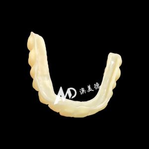 PMMA Hollow Temporary Bridges for Implant Provisional Cases