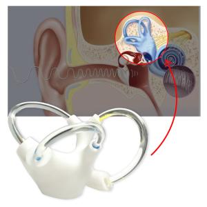 Balance Cochlea Inner Ear Cranial Nerve Rehabilitation Anatomical Function