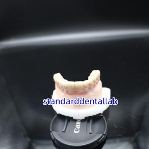 Digital Dental Malo Implant Bridge Titanium Ivoclar Hybrid Zirconia Bridge