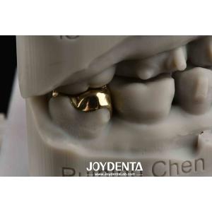 Oral Rehabilitation With Dental Achieve Brighter And Healthier Smile