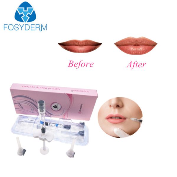 Buy 2ml Dermal Cross Linked Hyaluronic Pen Fillers at wholesale prices