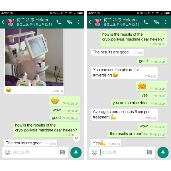 4 cryo handles vacuum freezing fat cryolipolysis machine/cryotherapy machine whole body