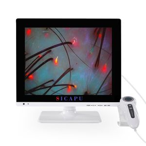 Handheld HD Hair Analyzer Machine Hair Follicle Growth Treatment For Salon