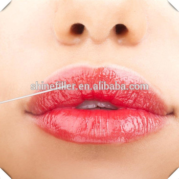 Korea HA Dermal Fillers For Buttocks , 10ml Butt Lifting Injectable Hyaluronic Acid Gel