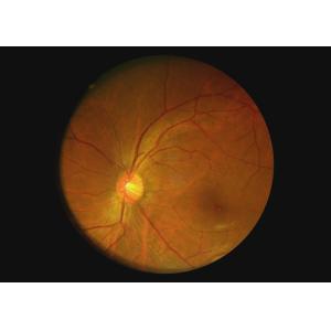 Ophthalmic Optical Equipment Throat Camera Video Otoscope Dermatoscope Digital