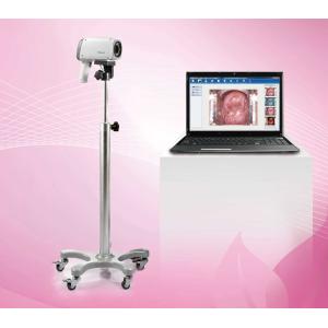 EDAN C3A&C6A Video Colposcope