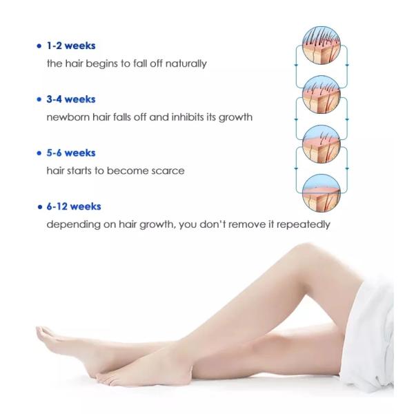 Laser Whole Body Hair Removal Machine IPL Beauty Equipment With Pigmentation Treatment