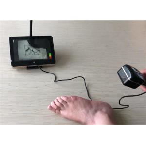 Accuracy < 0.2mm Medical Vascular Imager Infrared Vein Finder Vein Detected for