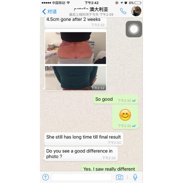 Beautiful Design High Quality Manufacturer Direct Sale Portable Cryolipolysis Machine For