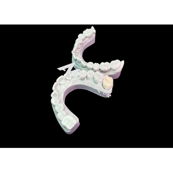 Precise Fit Zirconia Dental Crown Aesthetic Natural Colour Excellent Biocompatib