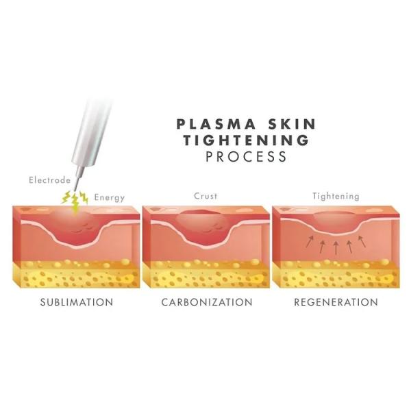 Hot Cold 2 In 1 Plasma Machine For Facial Lifting Therapy Hot Cold Plasma
