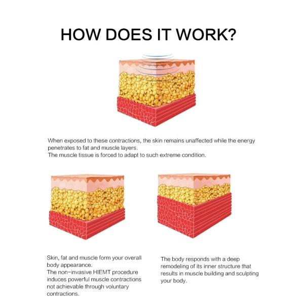 Fat Loss Magnetic 220v Electromagnetic Laser IPL Machine