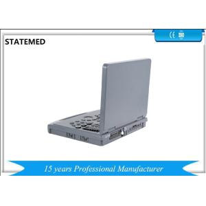 Full Digital Portable Diagnostic Ultrasound Machine Ultrasound Imaging Machine