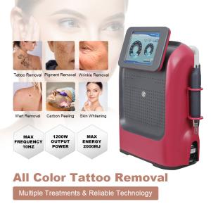 Advanced Pico Laser Machine For Precise And Effective Tattoo Removal