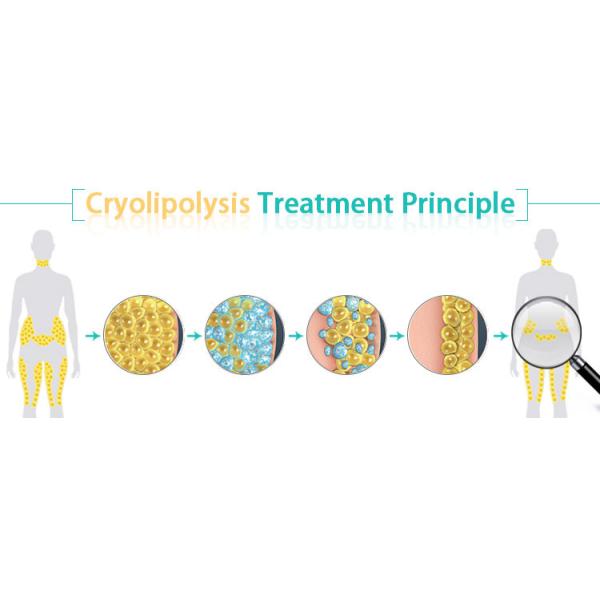 40k 5 In 1 5MHz Lipo Vacuum Slimming Machine