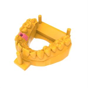 Biomimetic Gingival Photosensitive Resin Surgical Training Models Gum Resin