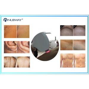 12*20mm Big Spot Size Painless 808nm Diode Laser Hair Removal Machine