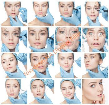 Korea HA Dermal Fillers For Buttocks , 10ml Butt Lifting Injectable Hyaluronic Acid Gel