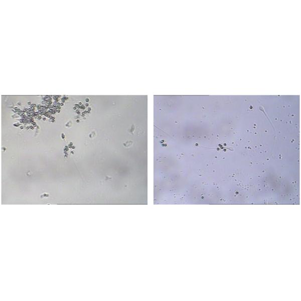 Infertility Diagnosis MAR IgG Kit For Determination IgG Antibody Coating Of Spermatozoa