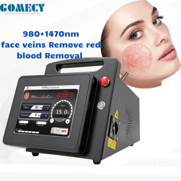 1470nm Laser Lipolysis Machine Submental 980nm Liposuction Neck Jowls Nasolabial