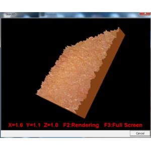 high pixel high image resolution skin analyser with 3D picture clearly see the