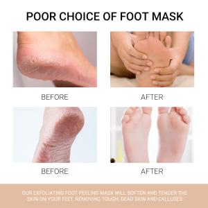 40ml Juice Peach Foot Peel Mask Deep Moisturizing Exfoliating Socks