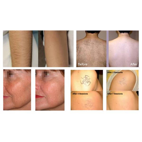 4 In1 RF IPL SHR Hair Removal Machine Multifunctional For Salon TUV Approved