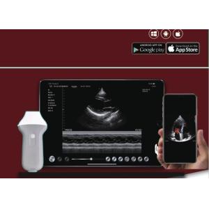 Doppler B Mode Ultrasound Scanner 2.2MHz Wireless Ultrasound Machine