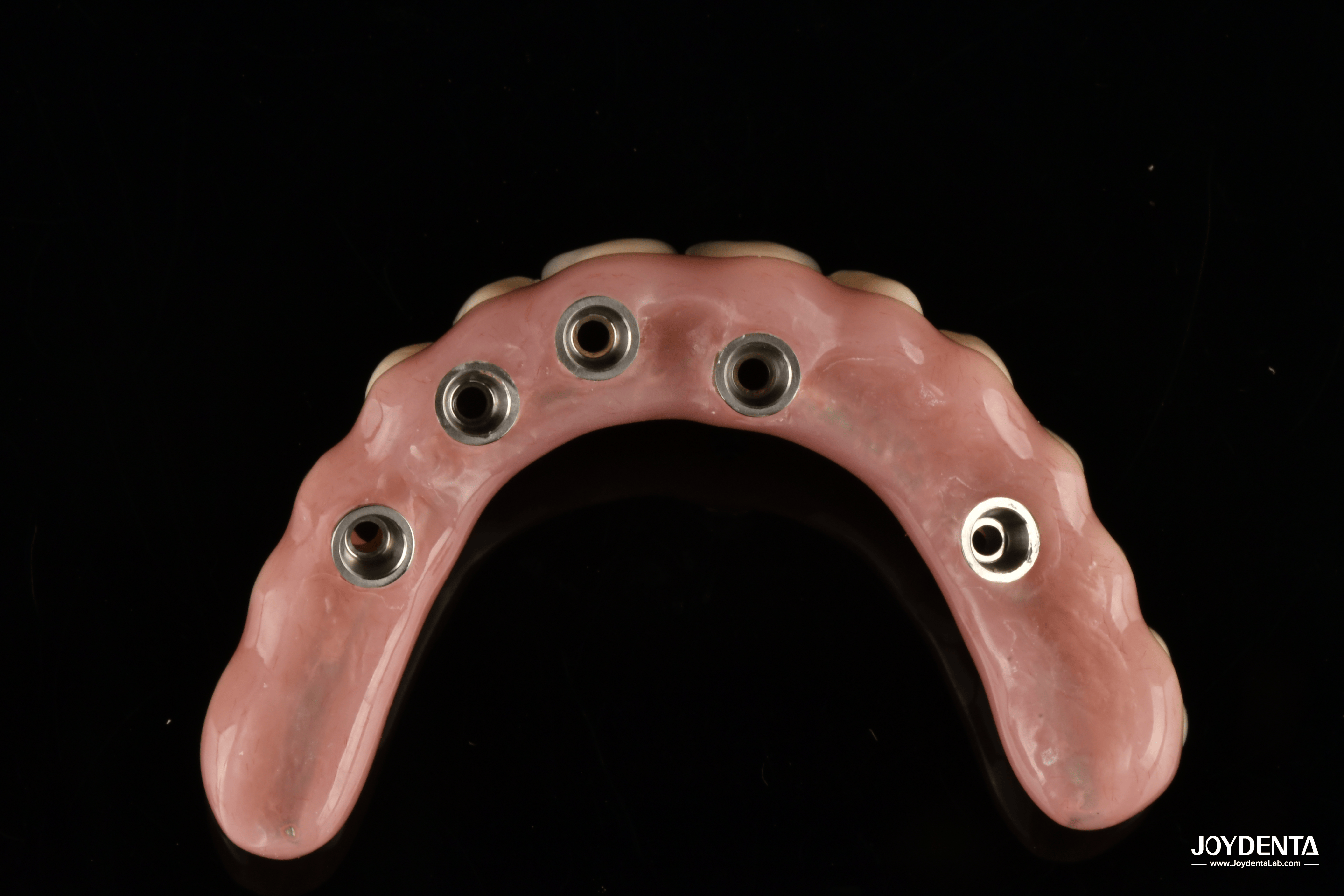 Redefining Full Arch Prosthetics: Unmatched Fit and Function with Our Ti-Base