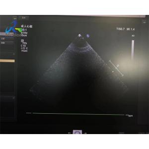 S5-1 Linear Array Ultrasound Transducer Probe Crystal Array Replacement