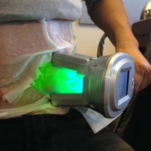 Cryotherapy/Weight Loss/Cryo Slimming Cryolipolysis Fat Freezing Machine Best