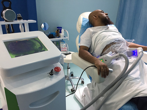 Beautiful Design High Quality Manufacturer Direct Sale Portable Cryolipolysis Machine For