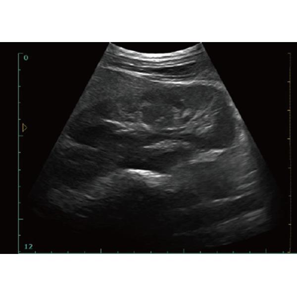 256 Frame Cine Portable Ultrasound Scanner 128 Permanent Storage With 12 Inch Screen