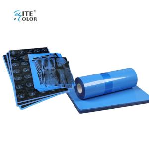 Inkjet Printing PET Blue Medical Film For X Ray A4 8x10 14x17 Sheets