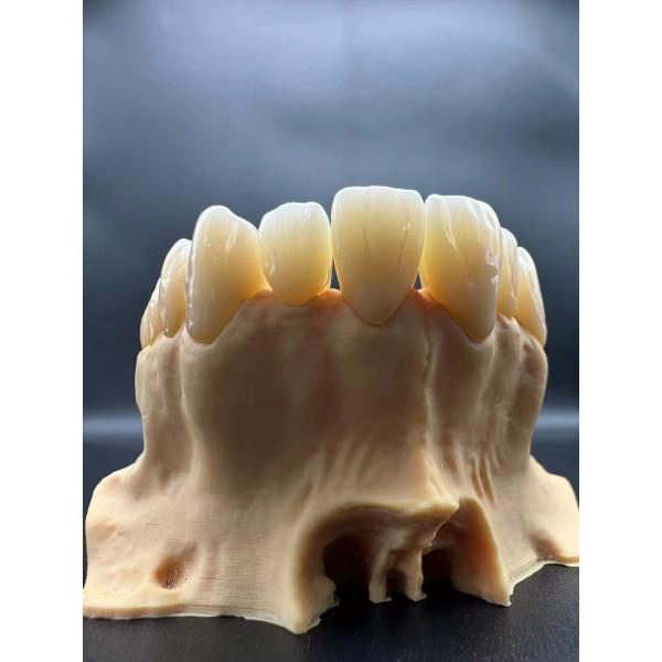 A3 Preshade Multilayer Dental Zirconia Block 98mm CAD CAM Milling System