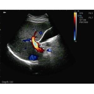 Hand Held Ultrasound Devices Portable Ultrasound Scanner Color Doppler With 16G