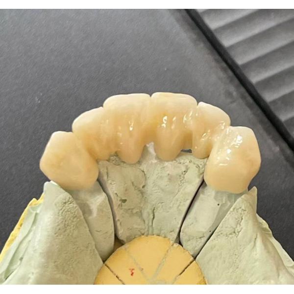 18mm A3 3D Multilayer Zirconia Block Dental 8 Layers With 1200Mpa Strength