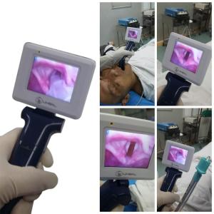 Quality Operating Portable Video Laryngoscope Using In Routine Endotracheal Intubation for sale