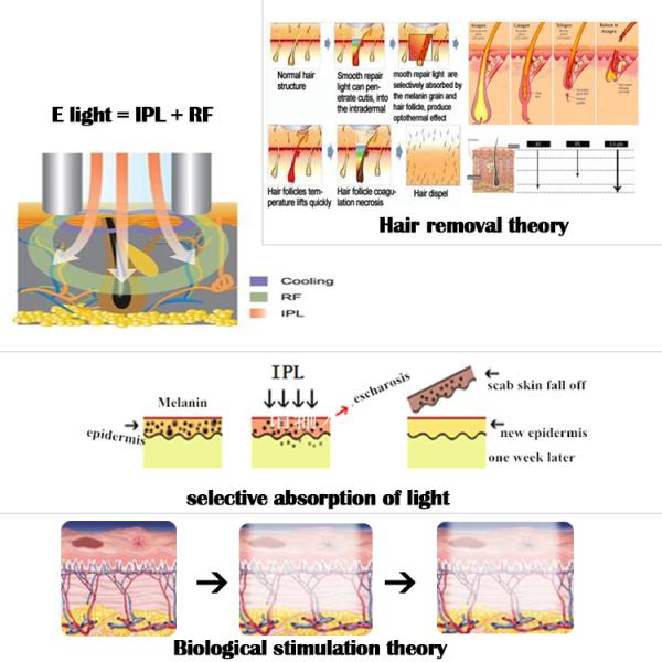 10.4 inch LCD laser hair removal device with 3 Handles IPL Pigmentation
