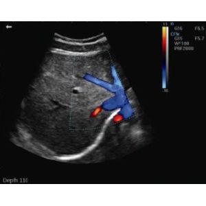 Full Digital Color Doppler Machine System Angle Adjustable Ultrasound Scanner