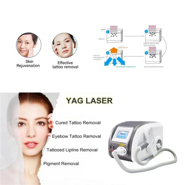 Buy Anybeauty Plus Nd Yag TUV Picosecond Laser Tattoo Removal Machine at wholesale prices