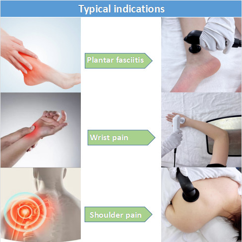 Multifunction Smart Tecar Therapy Machine Shockwave ED Treatment