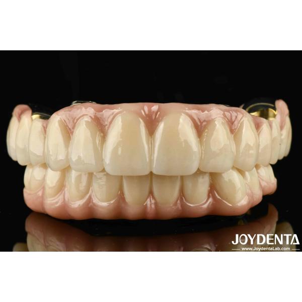 Buy Excellent Strength Ti-Bar Zirconia Hybrid Bridge For Natural Teeth And Gums Compatibility at wholesale prices