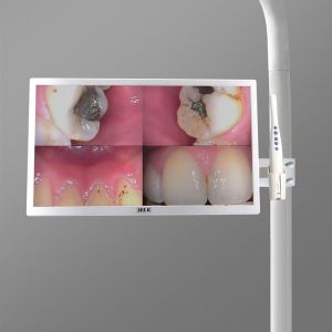5G Wireless Wifi Dental Intraoral Camera 19 Inch Dental Implant LCD Monitor