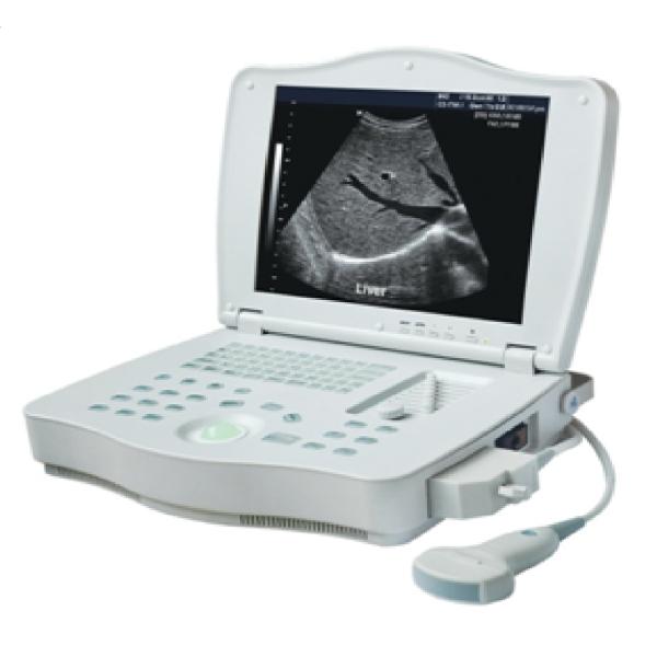AR-3000E1 Laptop Full Digital Ultrasound Scanner