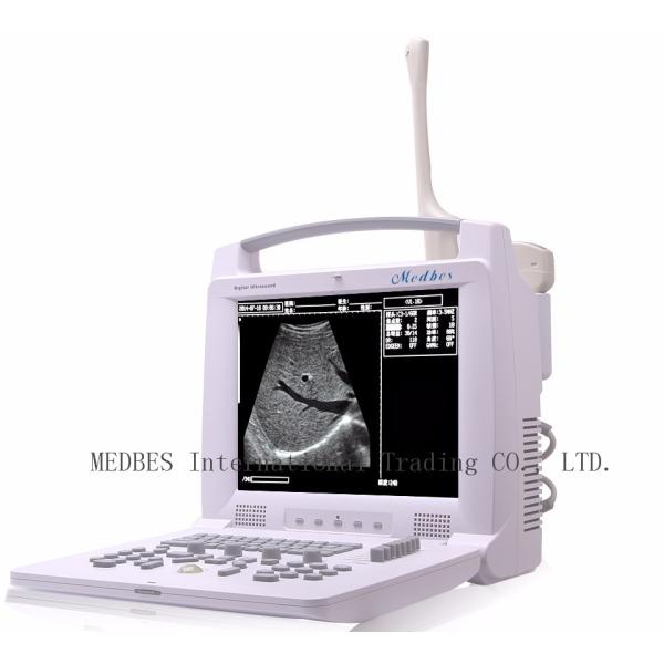 96 elements Medical Diagnosis Equipment Medical Instrument Diagnosis System